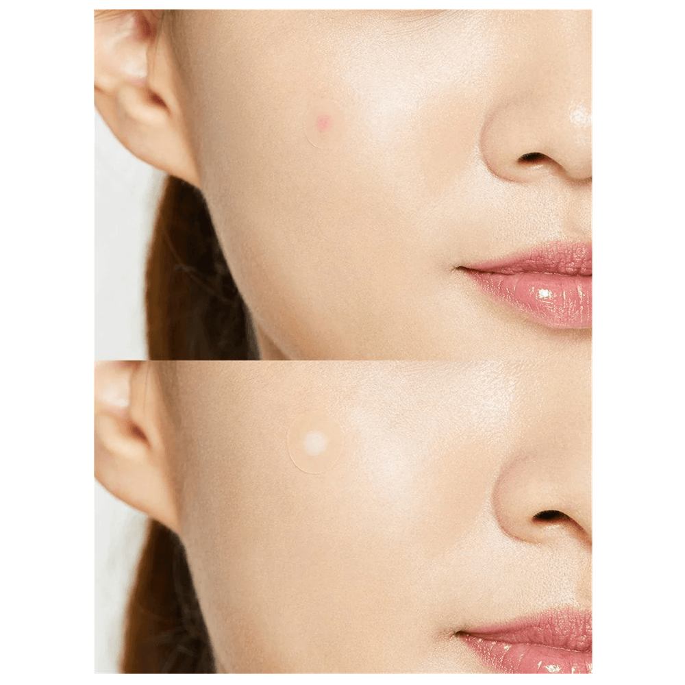 Parches para Granos COSRX x24