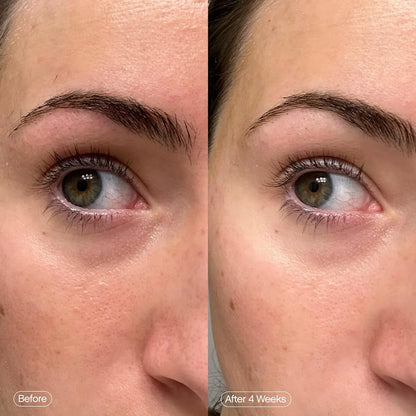 Parches para Ojeras Topicals Faded Under Eye Brightening &amp; Clearing Eye Masks